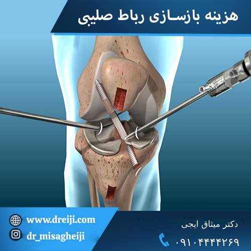 هزینه جراحی رباط صلیبی