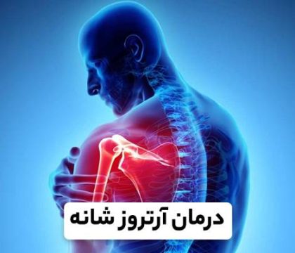 آرتروز شانه